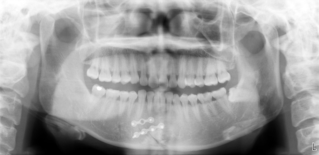 odontología deportiva